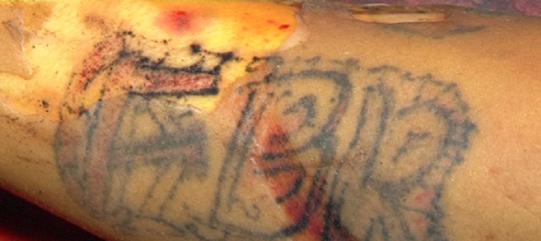 Ciri Tato Pada Pelaku Begas yang tewas