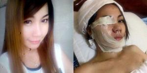 Cinta Ditolak Cairan Kimia Bertindak