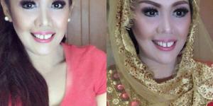 Ely Sugigi Lakukan Operasi Plastik jelang Nikah
