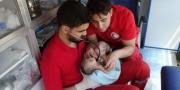 Bayi Berkepala Dua Lahir Ditengah Perang Suriah