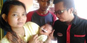Bayi Tanpa Kelopak Mata & Alat Kelamin di Balaraja Butuh Bantuan Donatur