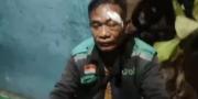Driver Ojol Babak Belur Dikeroyok 3 Pria Tak Dikenal di Depan Pasar Tanah Tinggi Tangerang